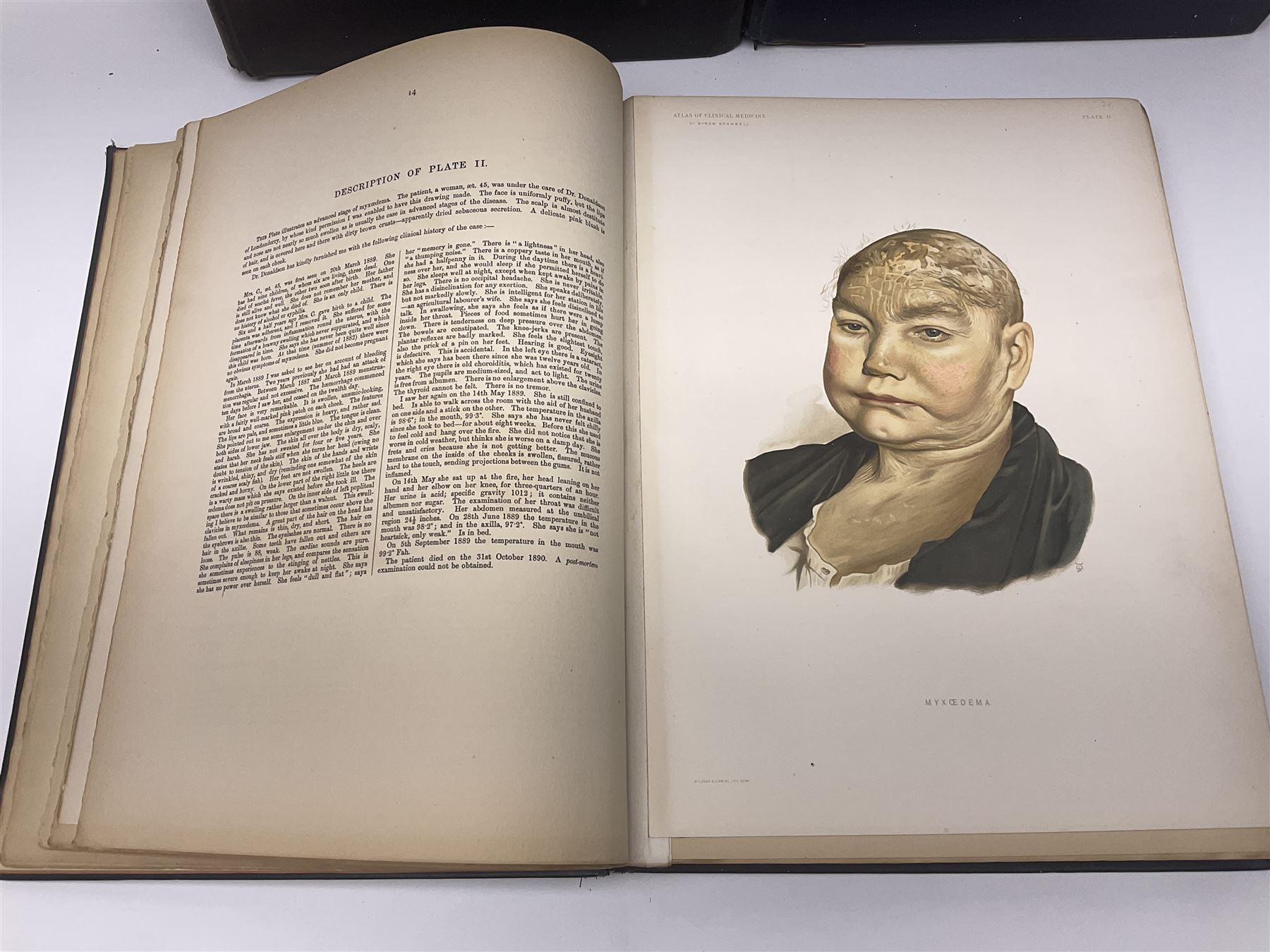 Bramwell, Byrom: Atlas of Clinical Medicine; three volumes, Edinburgh, printed by T & A Constable at the University Press, 1892-96, with numerous colour and black and white illustrations