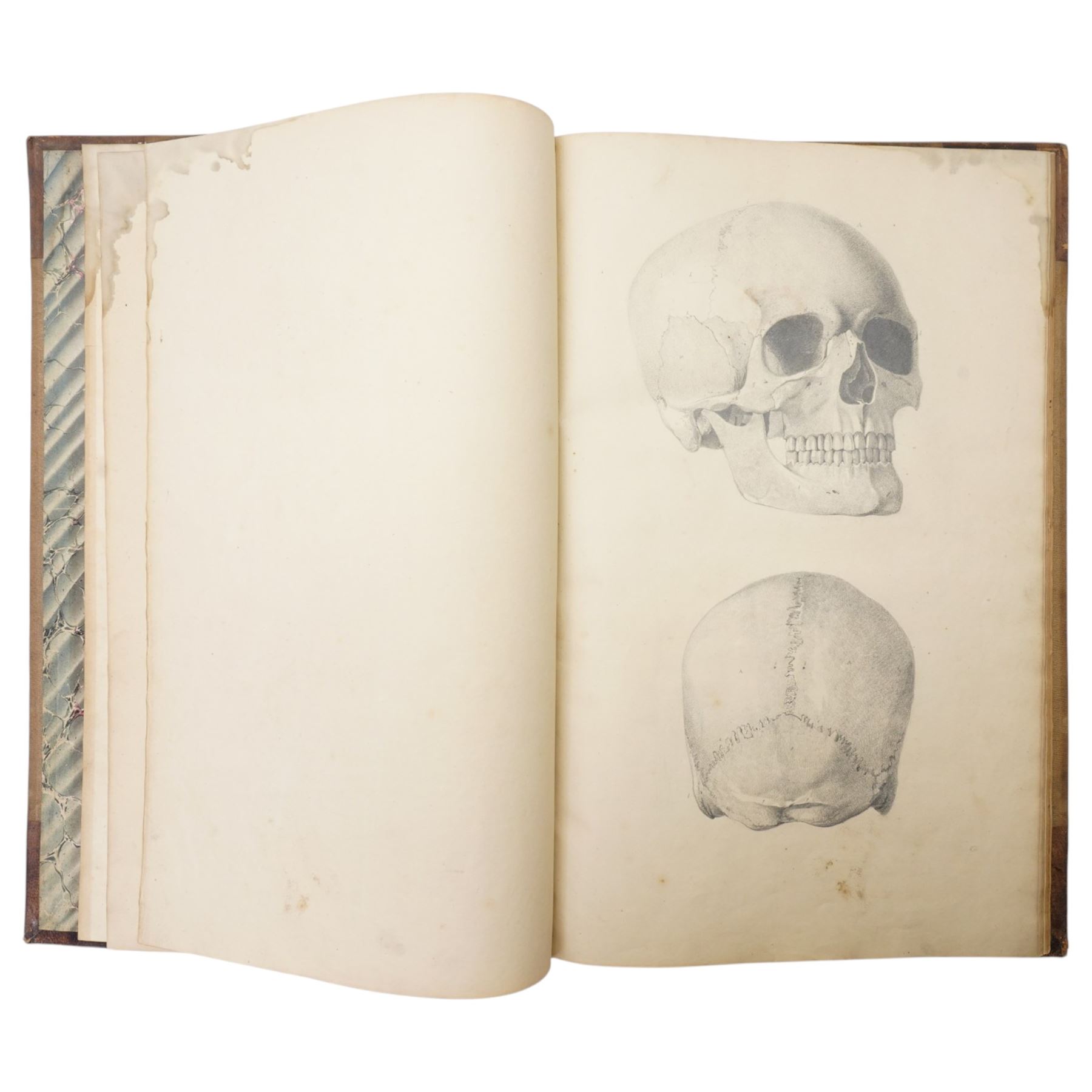 Thomas Hartley Cromek ANWS (British 1809-1873): The Human Skeleton Illustrated & Described 1827/1828, folio manuscript anatomical study album containing twelve pencil anatomical plates after nature with extensive handwritten descriptive text, original half-calf binding titled in gilt with marbled boards, with autograph inscription by Cromek dated Wakefield June 3rd 1859, and associated 1909 letter from J J Foster relating to the album’s provenance

Notes: 
Cromek is best known for his architectural and topographical watercolours, but his early anatomical work is documented. In 1827 he was commissioned by the Leeds surgeon Thomas Teale to produce detailed anatomical drawings, shortly before leaving for Italy in 1830.

The present album relates to this little-known early period. The binding is titled in gilt The Human Skeleton Illustrated & Described by T. H. Cromek, 1827, while Cromek’s autograph inscription, dated Wakefield June 3rd 1859, states that the drawings were made from nature in 1828 and submitted to Sir Astley Cooper, who praised them highly and wished Cromek to work for him as an anatomical draughtsman.

The album is accompanied by a letter dated 26th October 1909 from J. J. Foster, King William’s Hall, Durham, stating that he had in his possession a set of pencil drawings of the human skeleton and separate bones by T. H. Cromek, formerly in the possession of his late brother, James Foster, who had been in practice at Wakefield. The letter repeats the tradition that Sir Astley Cooper had described the drawings as the finest he had seen.

Sir Astley Cooper was one of the leading British surgeons of the early nineteenth century, associated with Guy’s Hospital and the Royal College of Surgeons.