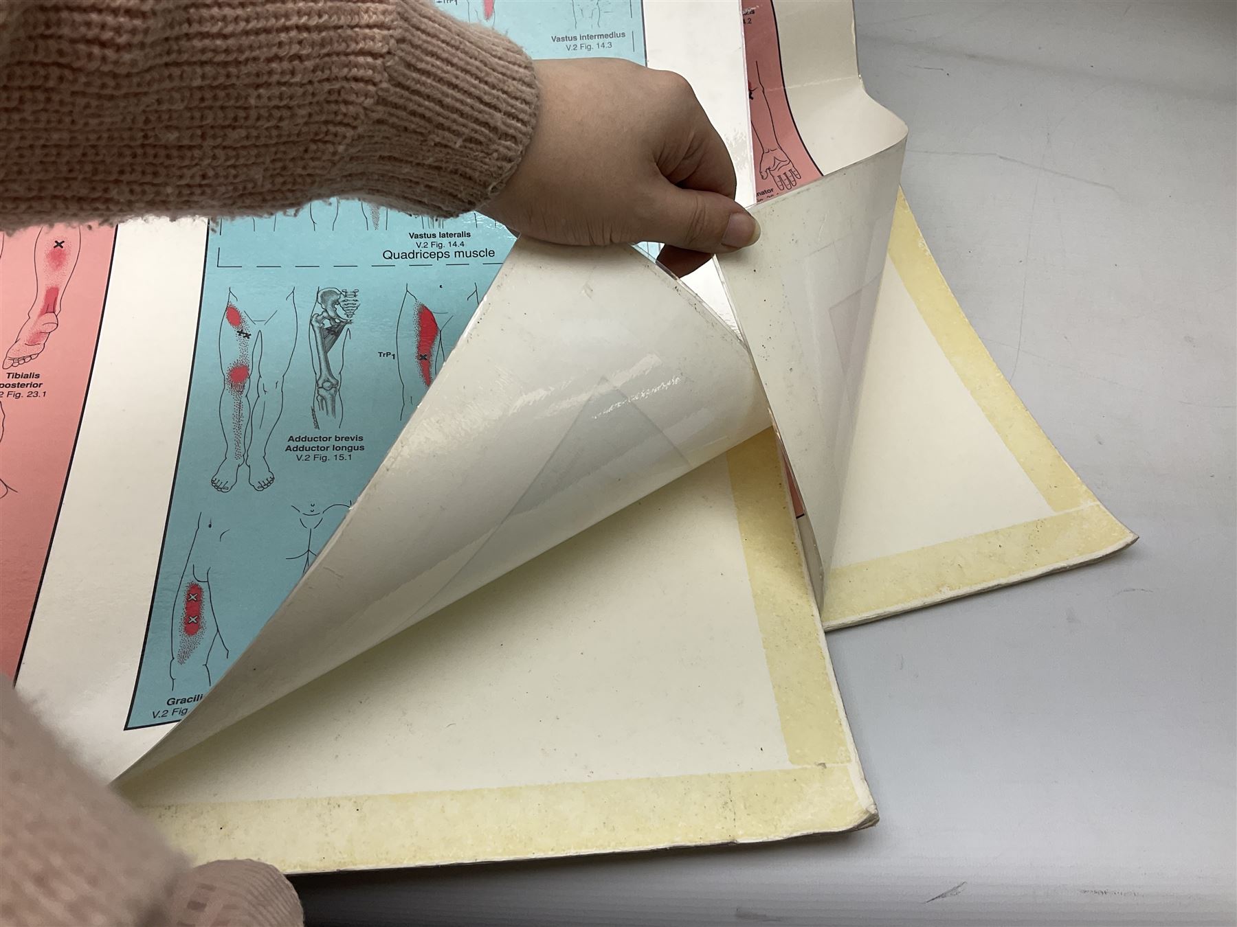 20th century anatomical diagram of 'The Respiratory stystem' by Adam Rouilly, on wooden scroll, approximately overall H114cm W77cm, together with two Travell and Simons 'Trigger Point Pain Patterns' posters, and two anatomical models
