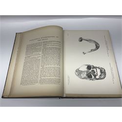 Bramwell, Byrom: Atlas of Clinical Medicine; three volumes, Edinburgh, printed by T & A Constable at the University Press, 1892-96, with numerous colour and black and white illustrations