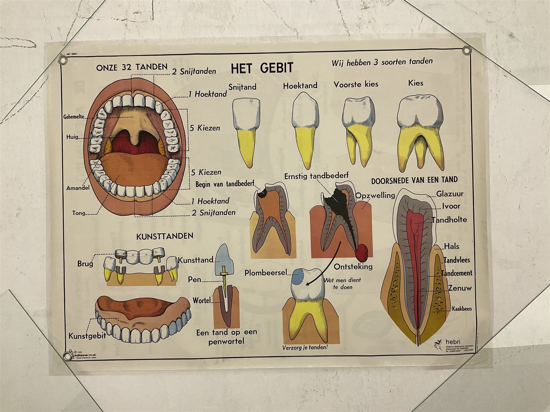 Five early 1980s Dutch medical posters, double sided decorated with colourful label anatomical diagrams, marked Hebri, Holland, W70cm H92cm